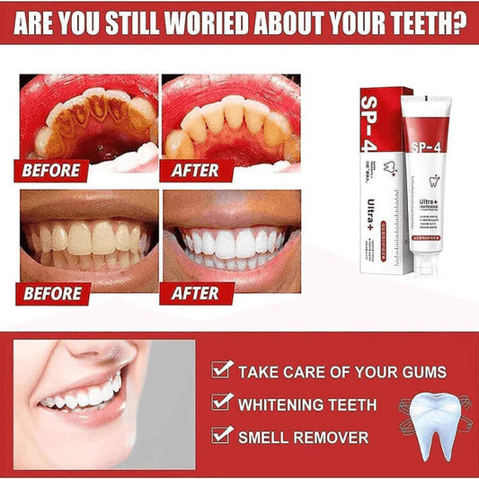 SP-4 Ultra Probiotic Toothpaste